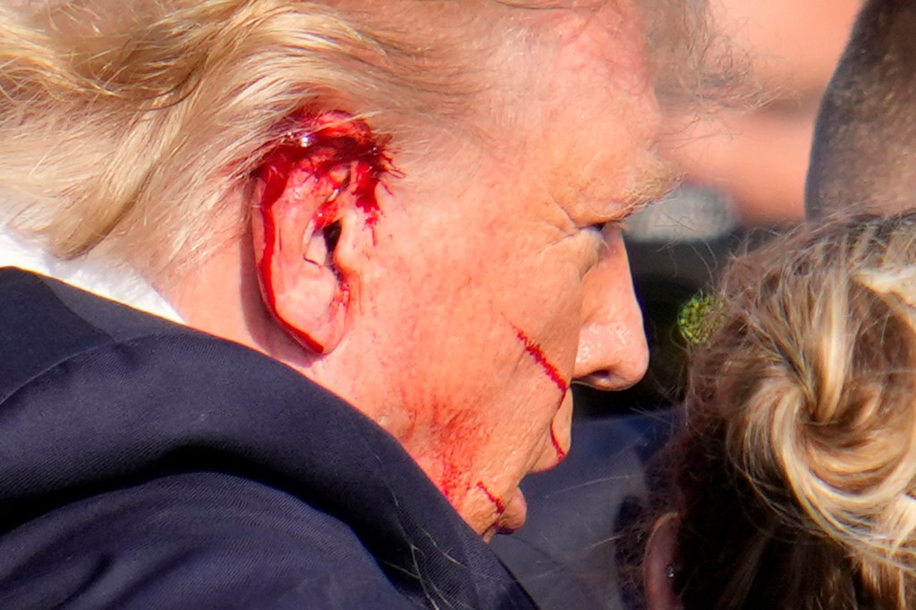 Donald Trump was grazed on the ear by a bullet that narrowly missed his skull.